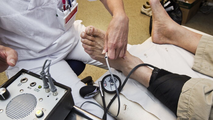 Bildet viser Aorta-screening 