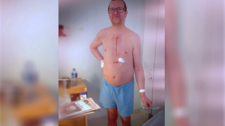 Bildet viser Tom-Sigvald Jensen på sykehuset. Han står med bar overkropp som viser et stort arr