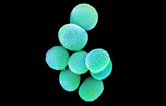 Bildet viser MRSA (meticillinresistente gule stafylokokker).