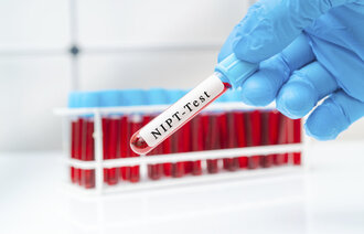 NIPT-test