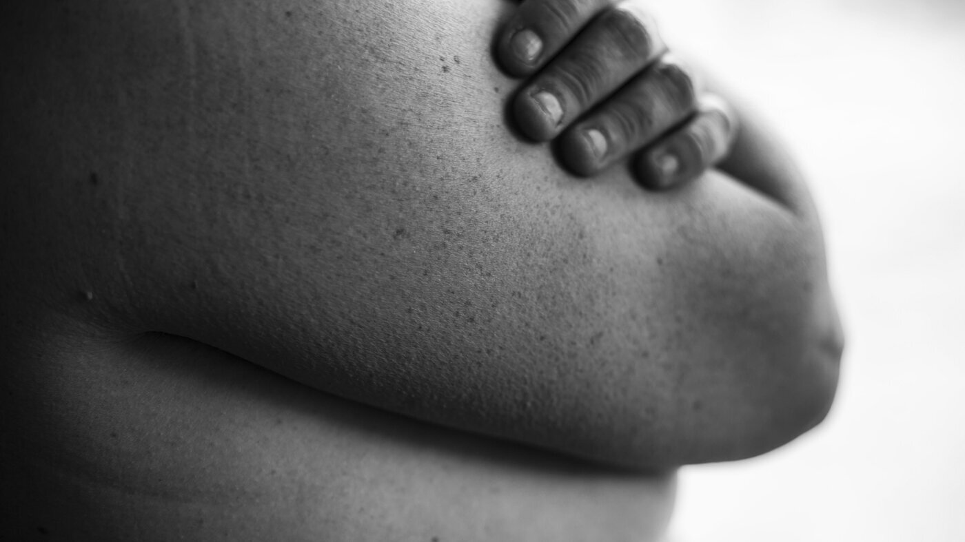 Seksualitet En kvinne holder armene over bysten