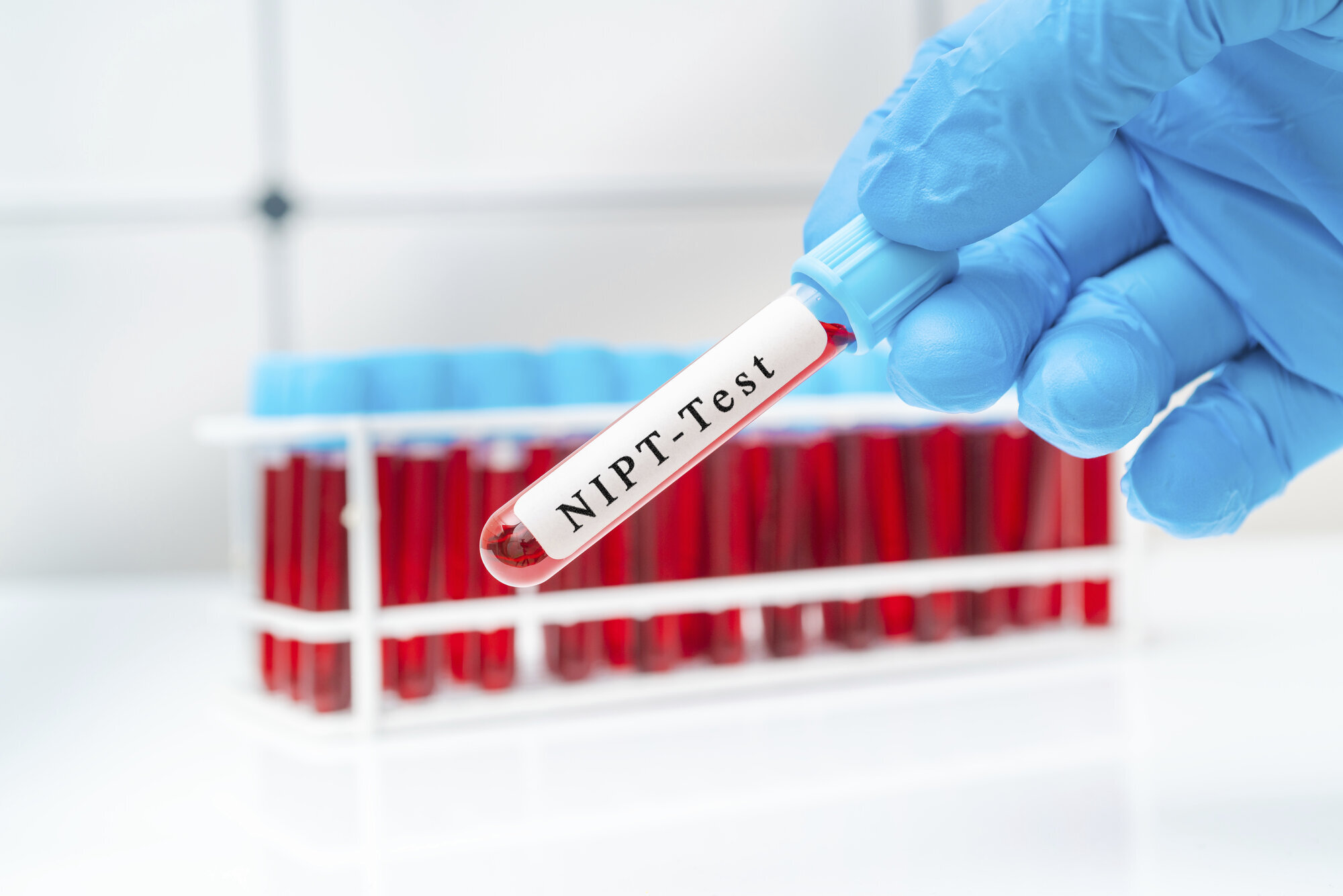 NIPT-test NIPT-test