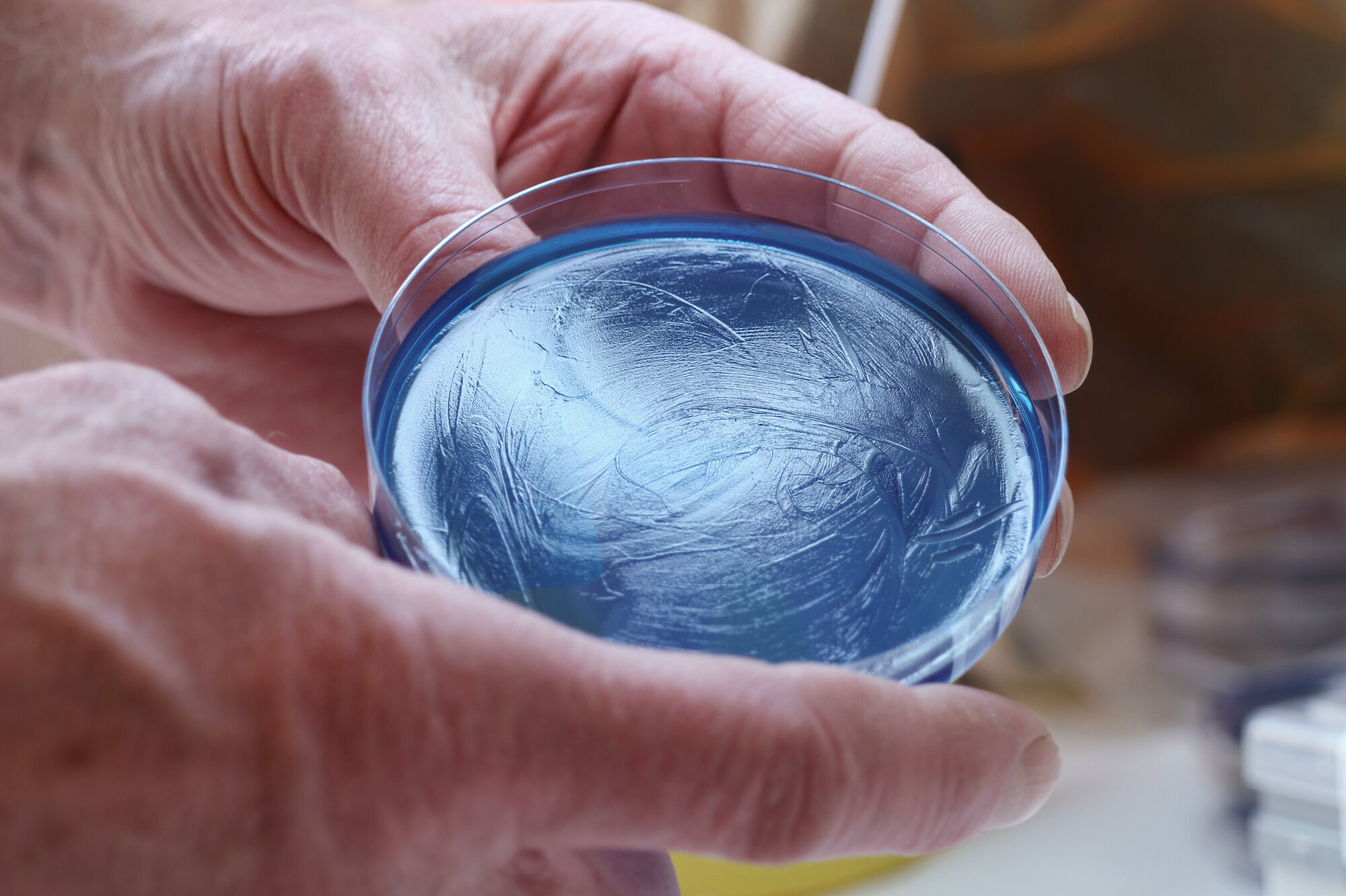 Pseudomonas aeruginosa Bildet viser en petriskål med Pseudomonas aeruginosa.