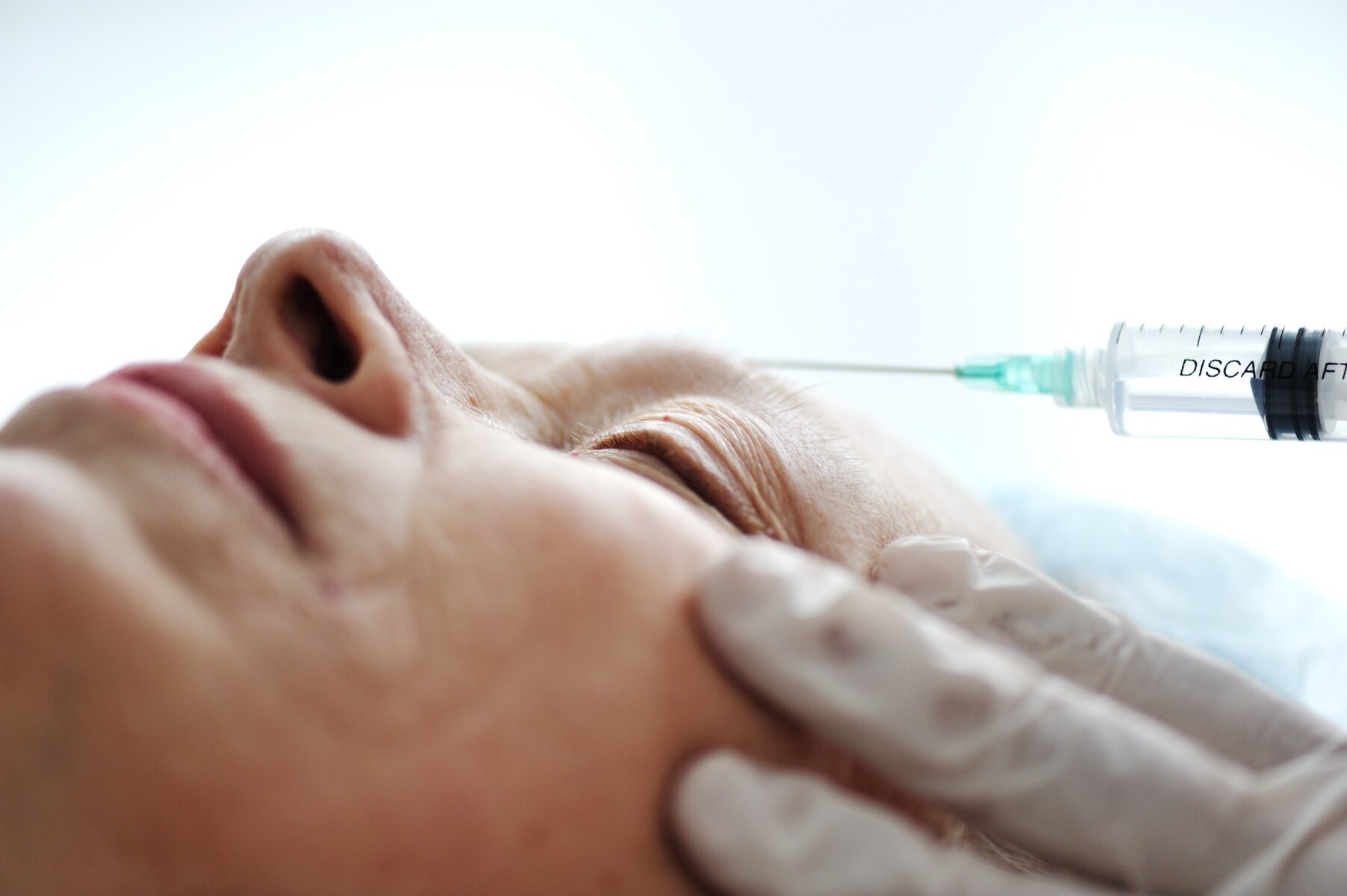 Bildet viser en dame som får Botox injeksjon Bildet viser en dame som får Botox injeksjon
