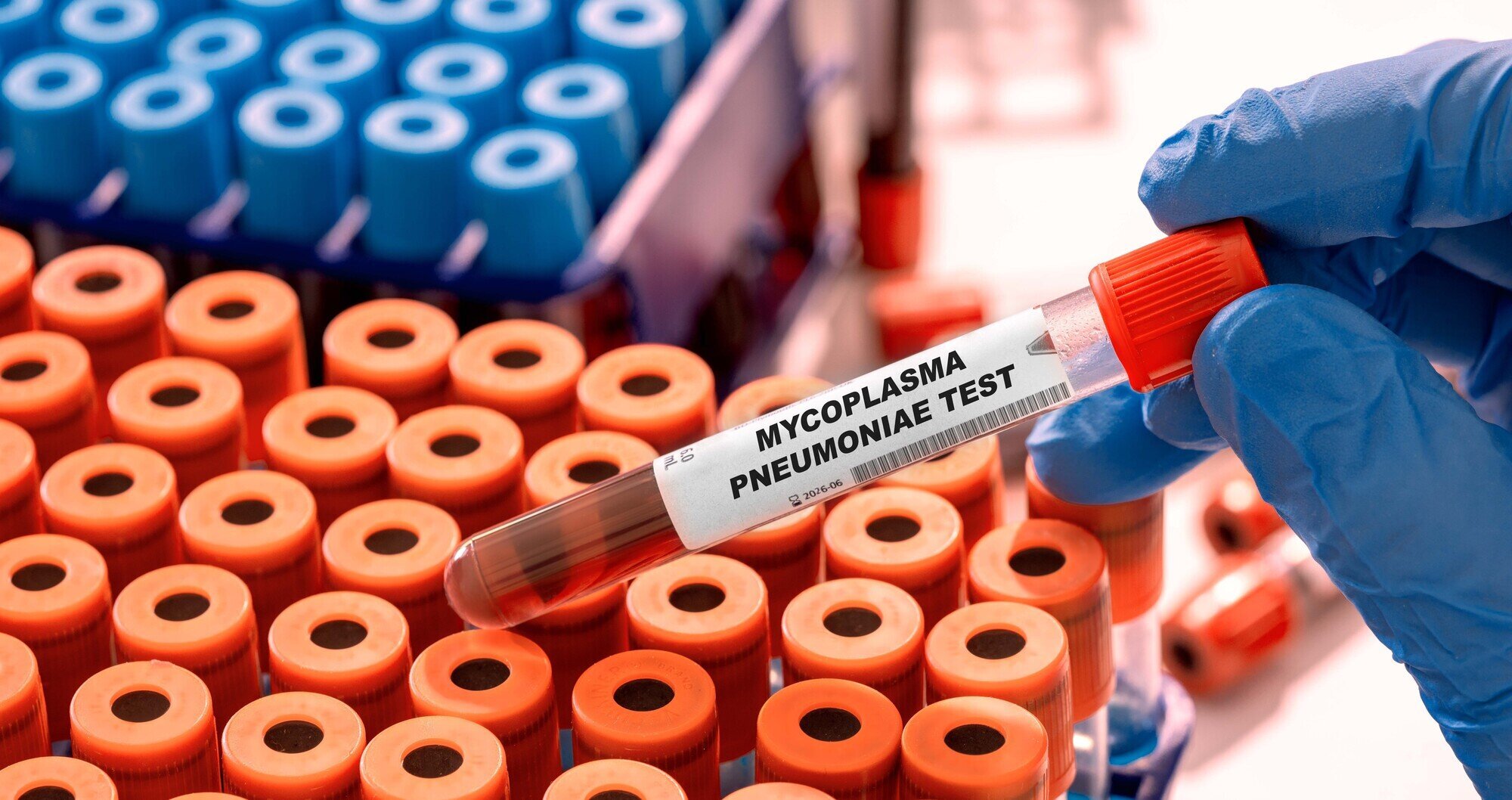 Bilde av mycoplasma pneumoniae-test
