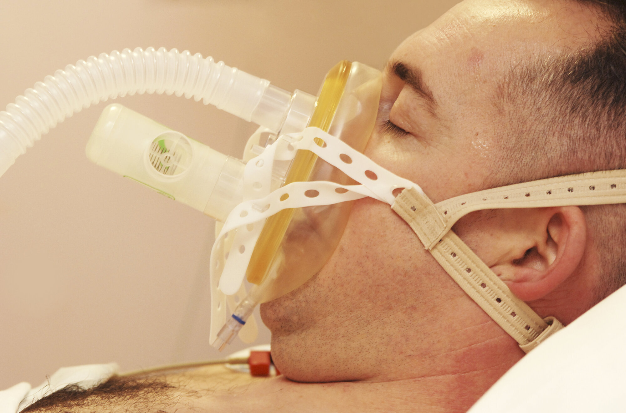Bildet viser mann som ligger på CPAP