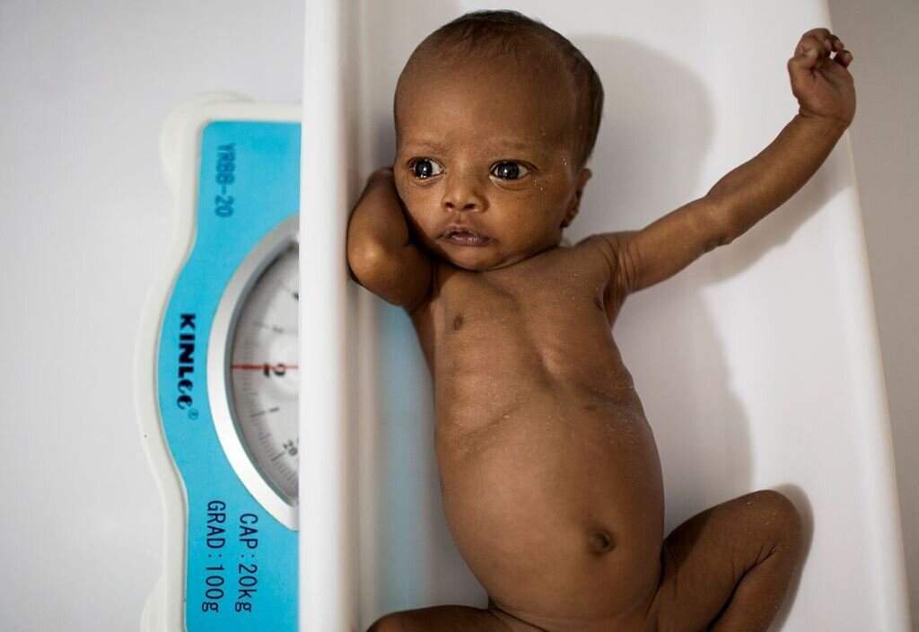 Nyfødt prematur i Somalia på vekt Nyfødt prematur i Somalia på vekt