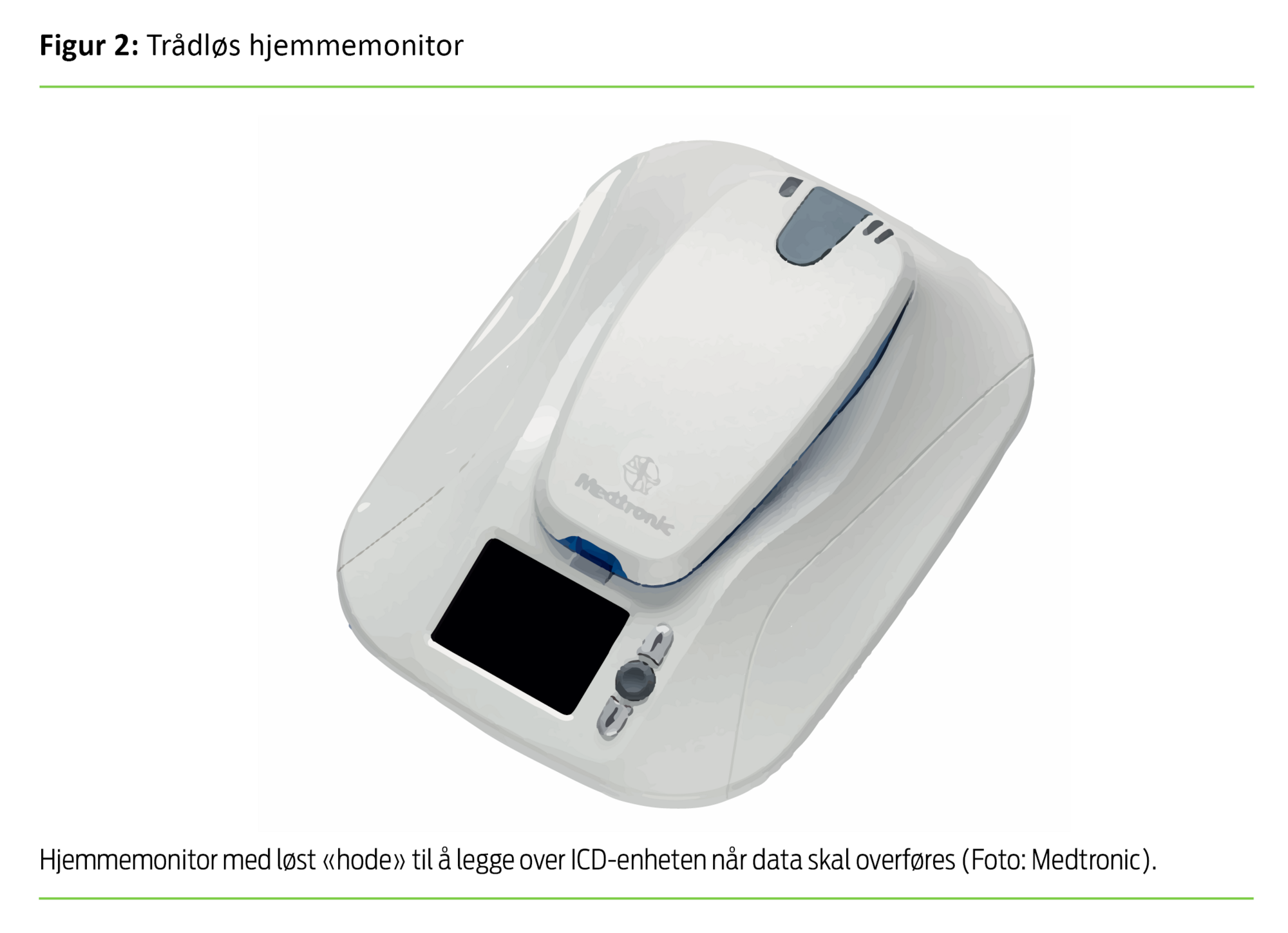 Figur 2. Trådløs hjemmemonitor