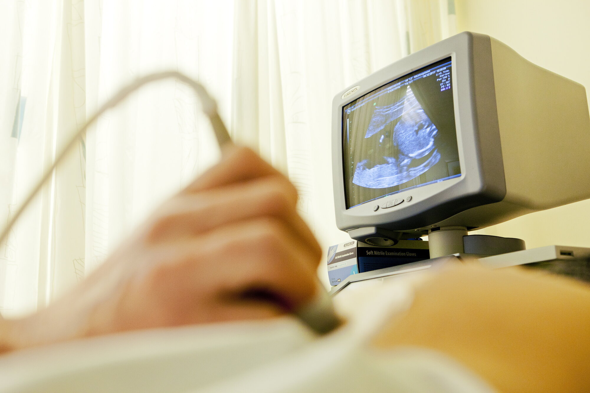 svangerskap, ultralyd Bildet viser en gravid mage som undersøkes med ultralyd.