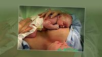 Nyfødt baby som ammes Bildet viser en nyfødt baby som ligger på brystet til moren og ammes