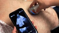 Bildet viser en sykepleier som utfører lungeultralyd på en pasient